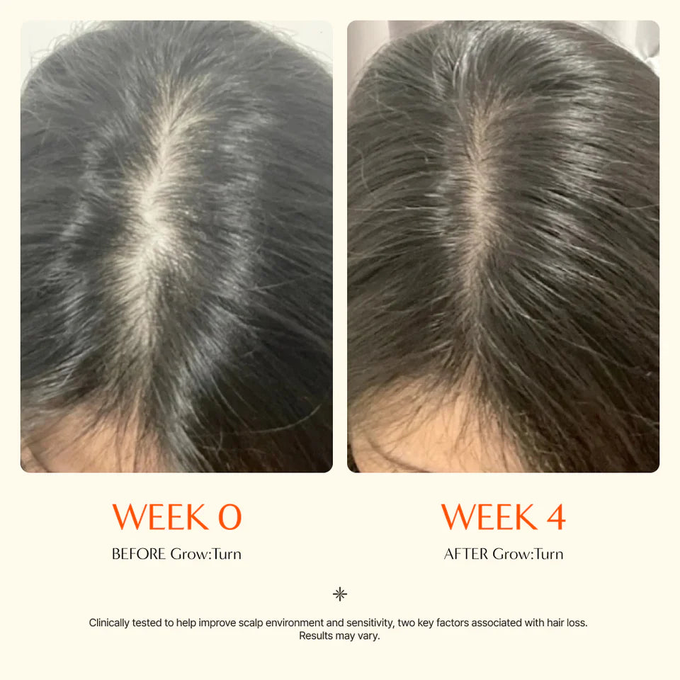 Azaluna Hair Grow