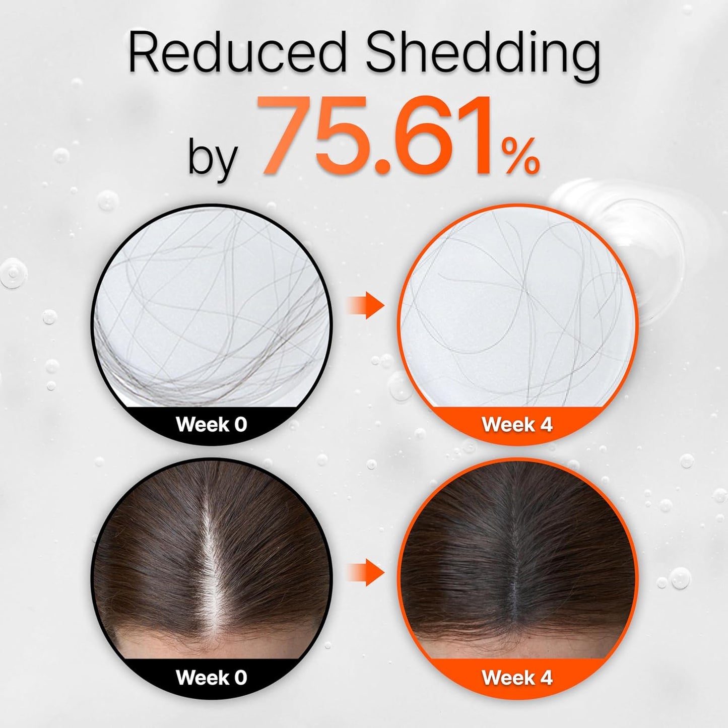 Azaluna Hair Grow